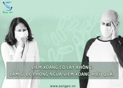 Viêm xoang có lây không? Làm gì để phòng ngừa viêm xoang hiệu quả?