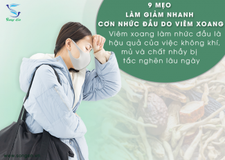 9 mẹo làm giảm nhanh cơn nhức đầu do viêm xoang